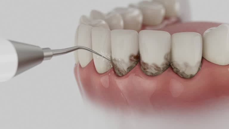Trusted Dental Crowns And Bridges service in Hillsdale, NJ - Dentist Open Now
